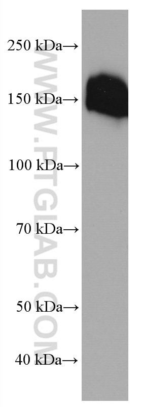 Western Blot (WB) analysis of human heart tissue using Collagen Type VI  Monoclonal antibody (66824-1-Ig)