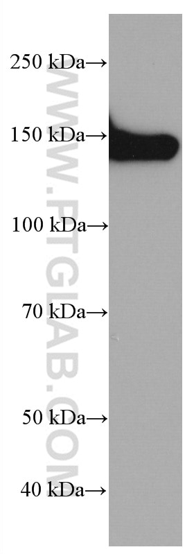 Western Blot (WB) analysis of human skeletal muscle tissue using Collagen Type VI  Monoclonal antibody (66824-1-Ig)