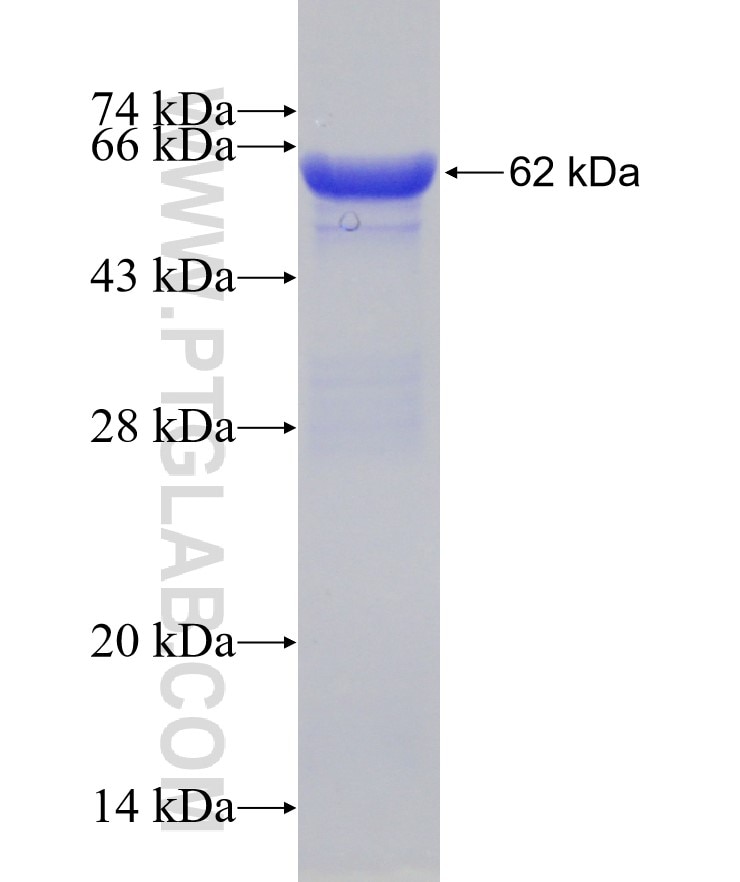 COL6A1 fusion protein Ag10288 SDS-PAGE