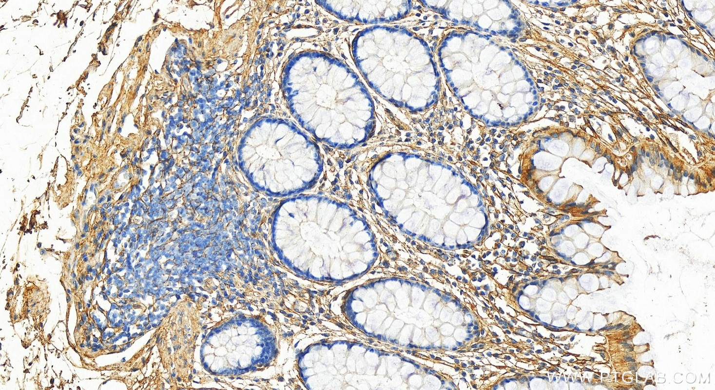 Immunohistochemistry (IHC) staining of human colon tissue using Collagen Type VI Polyclonal antibody (14853-1-AP)