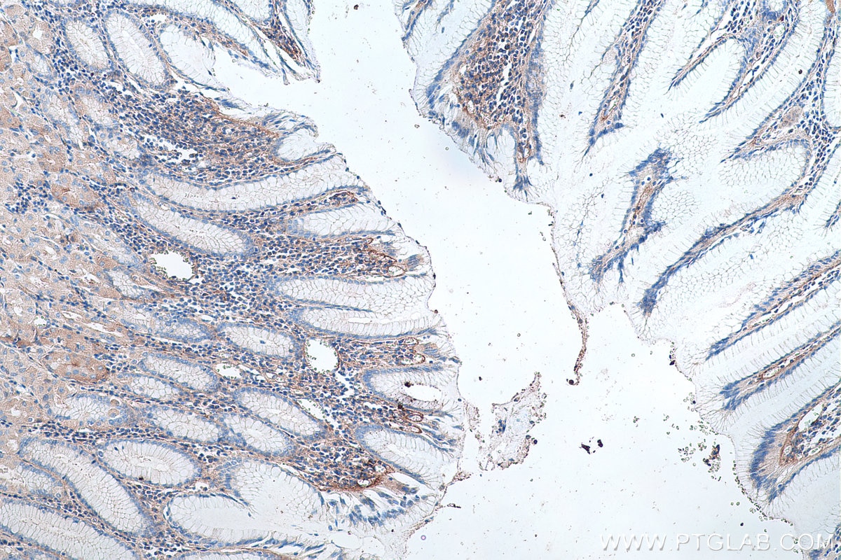 Immunohistochemistry (IHC) staining of human stomach tissue using Collagen Type VI Polyclonal antibody (14853-1-AP)