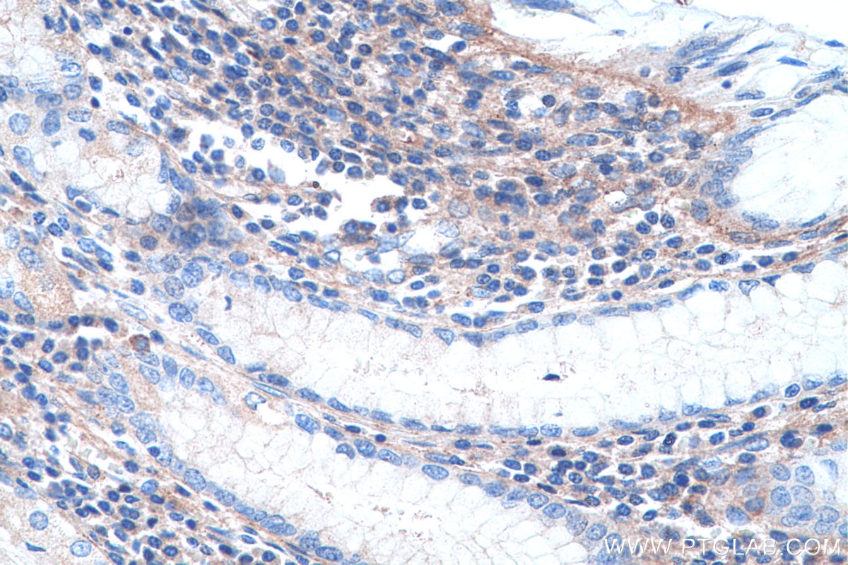 Immunohistochemistry (IHC) staining of human stomach tissue using Collagen Type VI Polyclonal antibody (14853-1-AP)