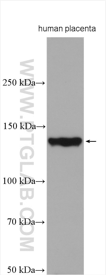 Western Blot (WB) analysis of various lysates using Collagen Type VI Polyclonal antibody (14853-1-AP)