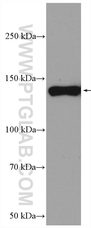 Western Blot (WB) analysis of pig skin tissue using Collagen Type VI Polyclonal antibody (14853-1-AP)