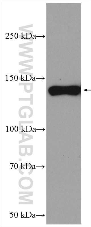 WB analysis of pig skin using 14853-1-AP