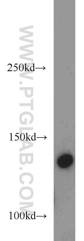 Western Blot (WB) analysis of human heart tissue using Collagen Type VI Polyclonal antibody (14853-1-AP)