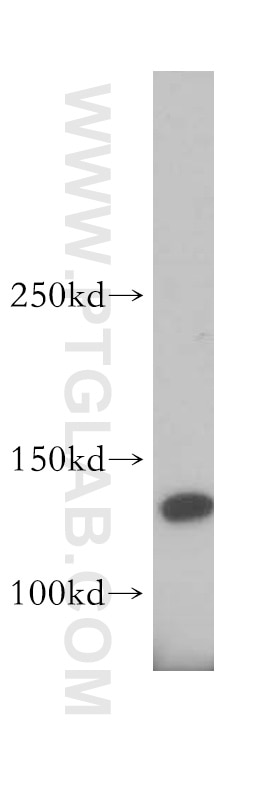 Collagen Type VI Polyclonal antibody