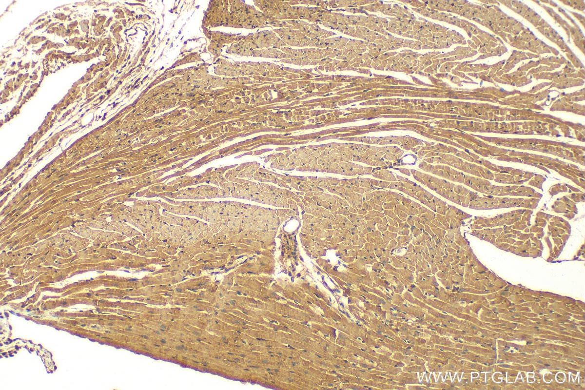 Immunohistochemistry (IHC) staining of mouse heart tissue using COL6A6 Polyclonal antibody (22302-1-AP)