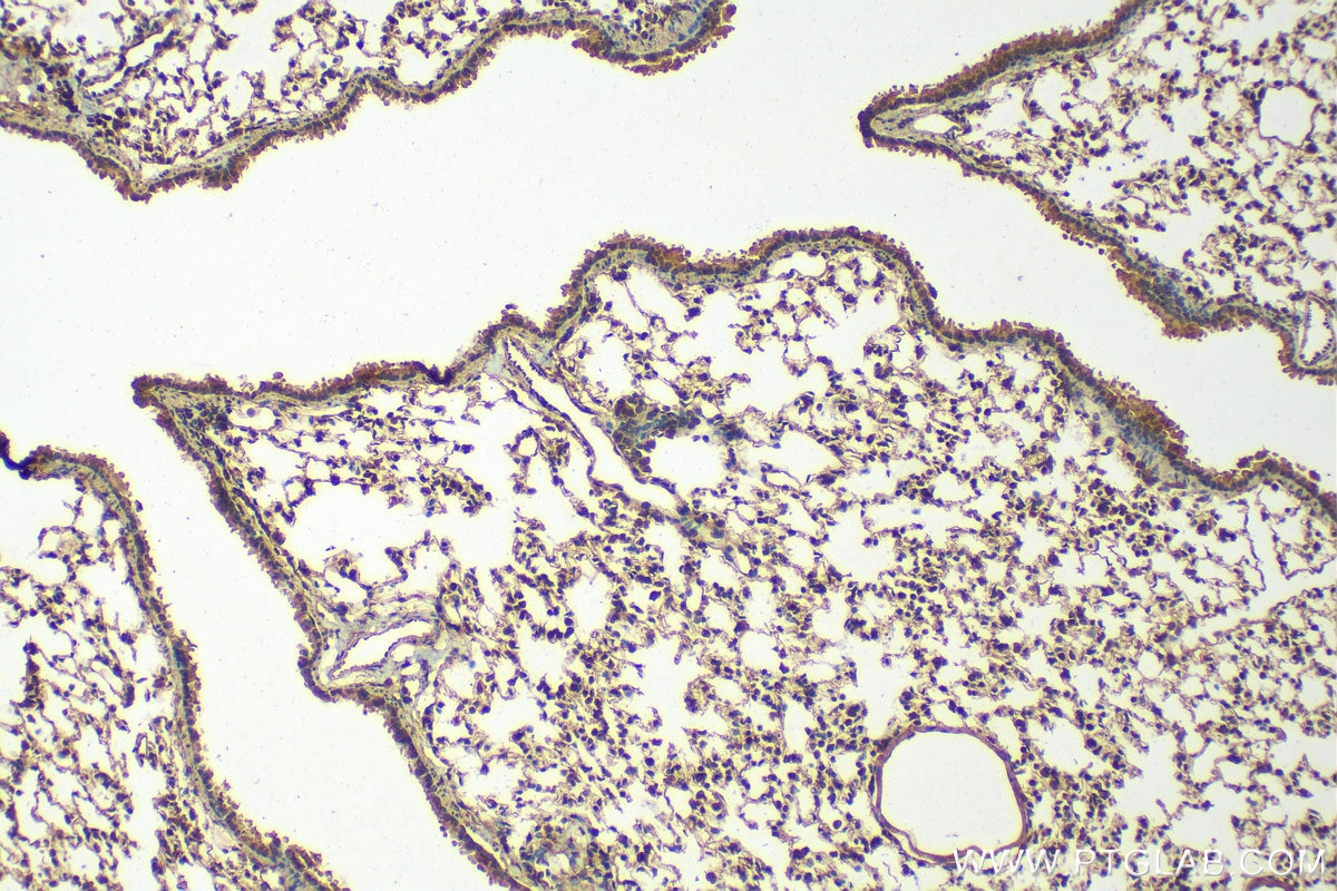 Immunohistochemistry (IHC) staining of mouse lung tissue using COL6A6 Polyclonal antibody (22302-1-AP)