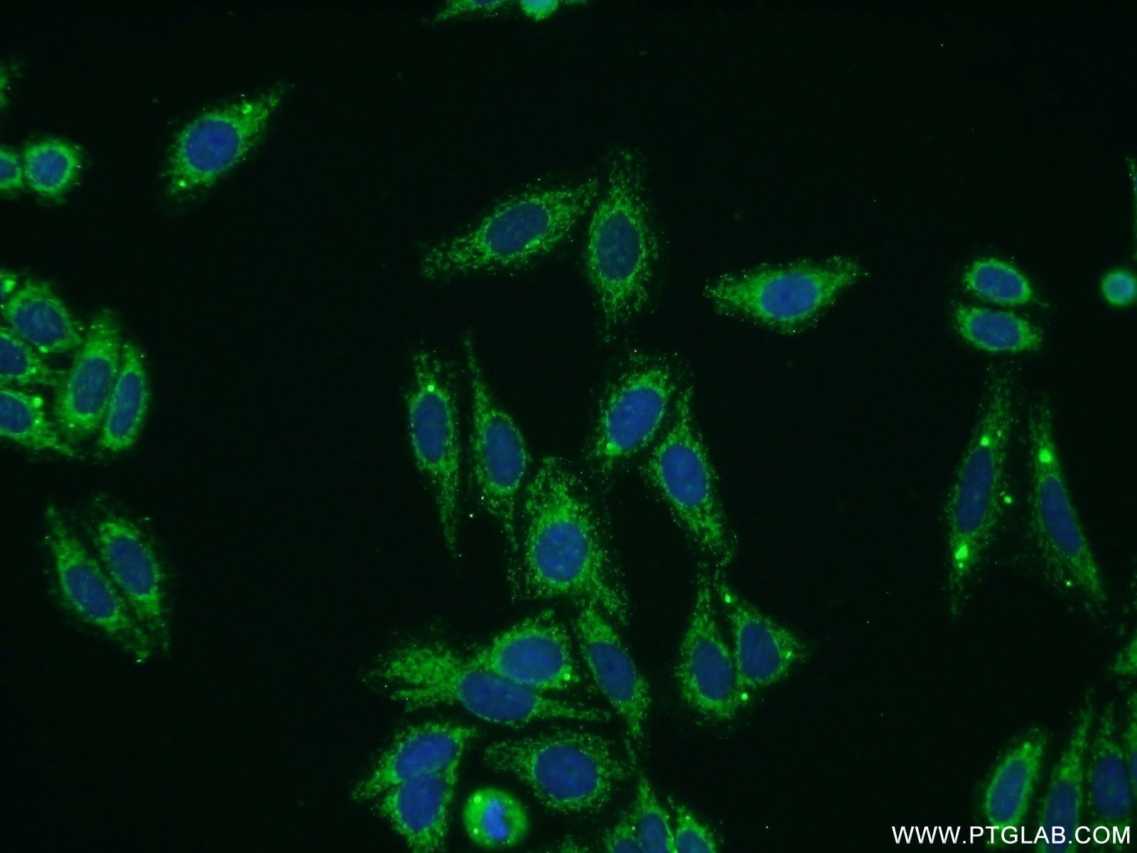 Immunofluorescence (IF) / fluorescent staining of HepG2 cells using Collagen Type VIII Polyclonal antibody (17251-1-AP)