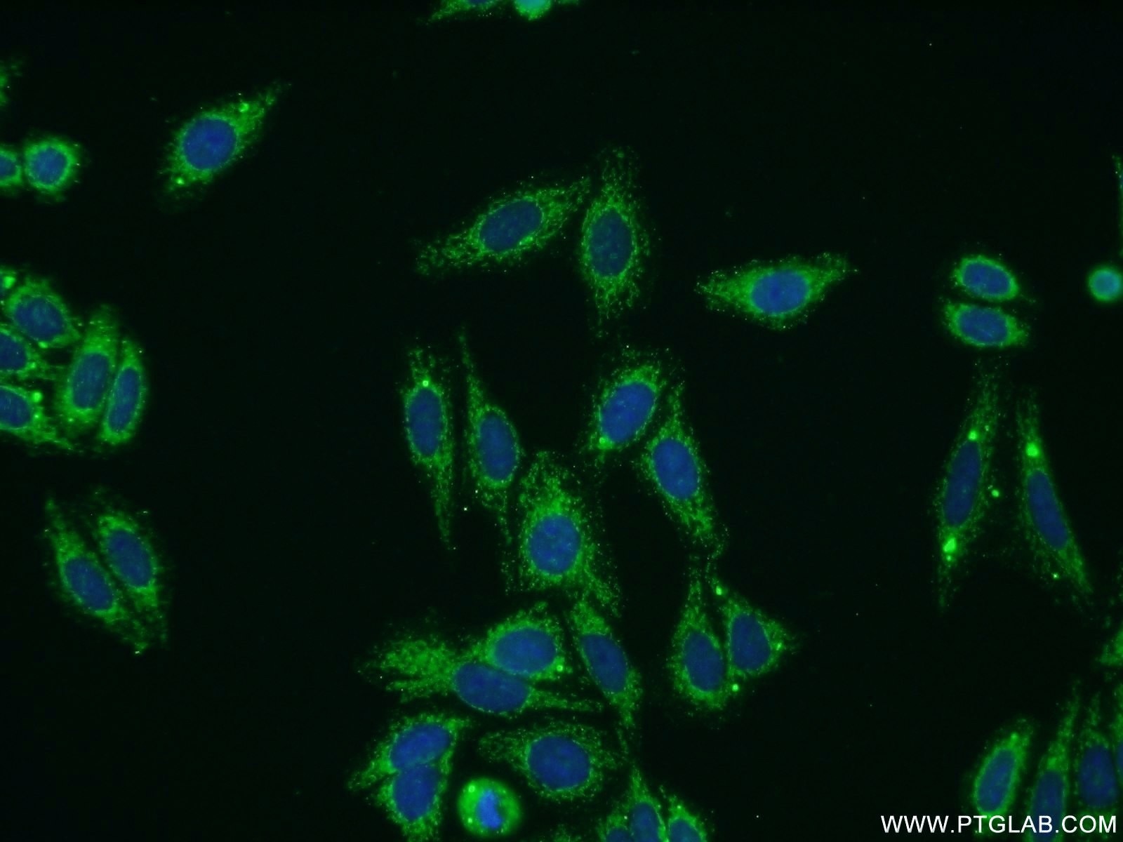 Immunofluorescence (IF) / fluorescent staining of HepG2 cells using COL8A1 Polyclonal antibody (17251-1-AP)
