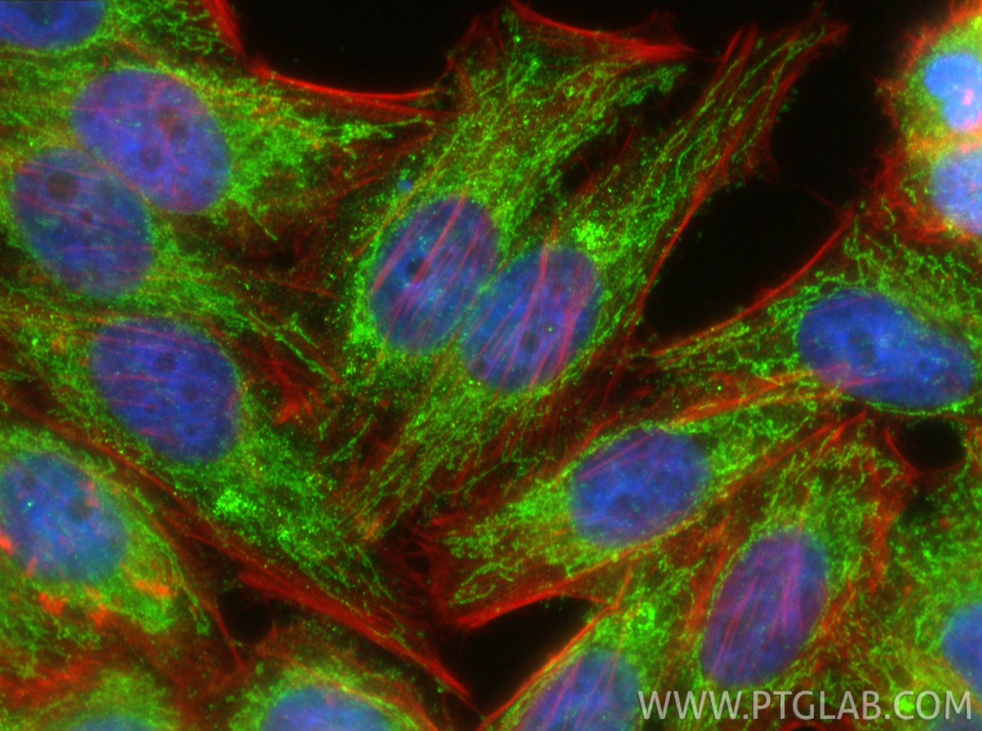 Immunofluorescence (IF) / fluorescent staining of HepG2 cells using COL8A1 Polyclonal antibody (17251-1-AP)