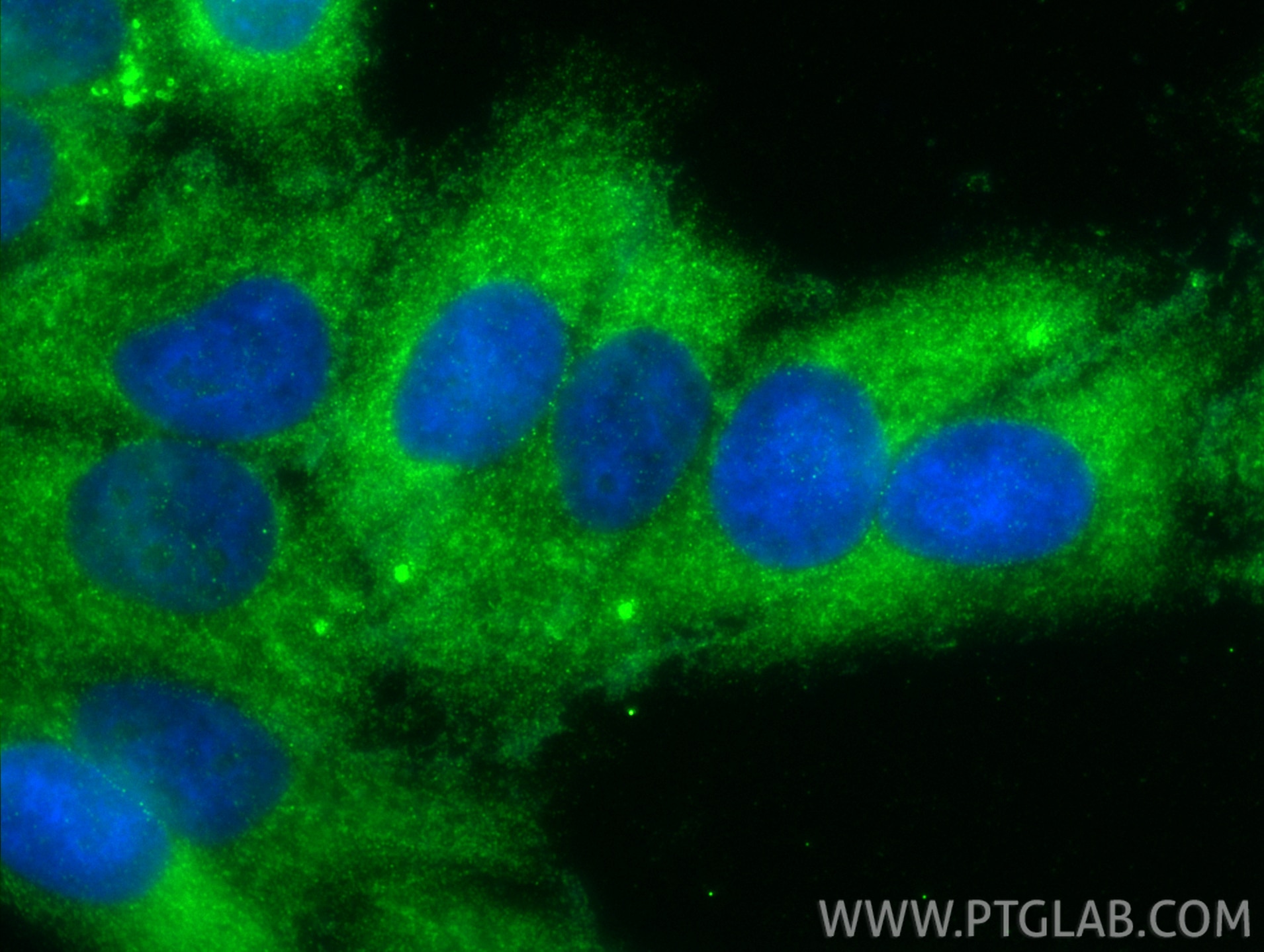Immunofluorescence (IF) / fluorescent staining of HepG2 cells using COL8A1 Polyclonal antibody (17251-1-AP)