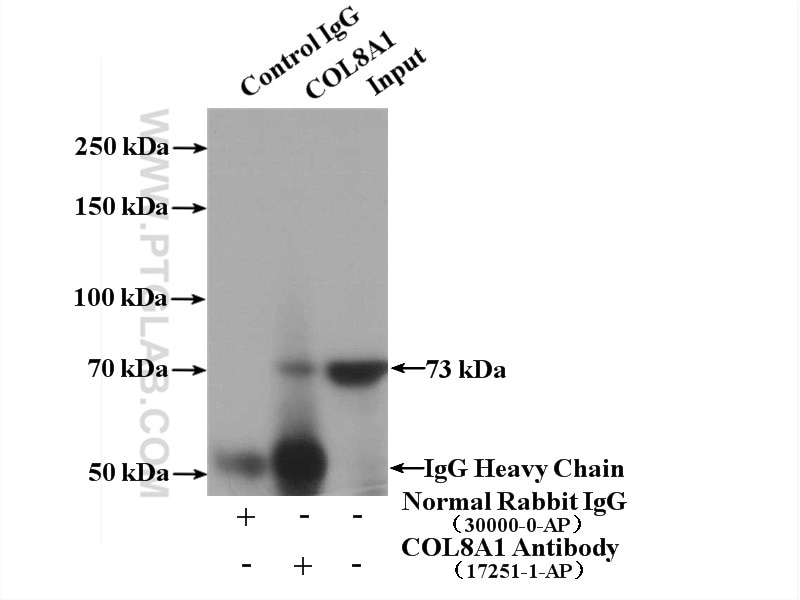 Immunoprecipitation (IP) experiment of HepG2 cells using Collagen Type VIII Polyclonal antibody (17251-1-AP)