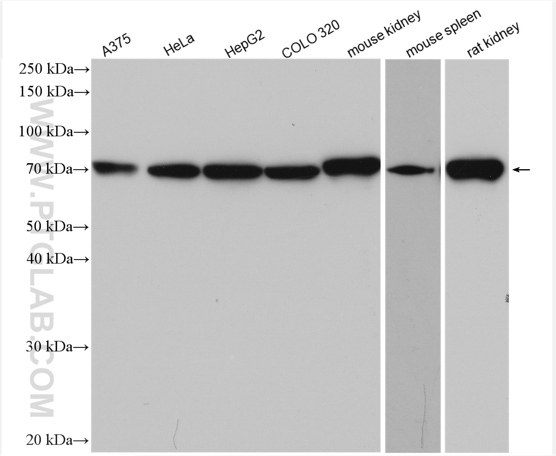 Western Blot (WB) analysis of various lysates using Collagen Type VIII Polyclonal antibody (17251-1-AP)