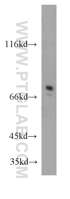 Collagen Type VIII