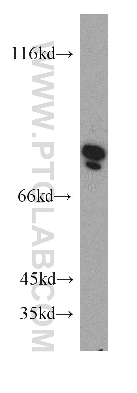 Collagen Type VIII Polyclonal antibody