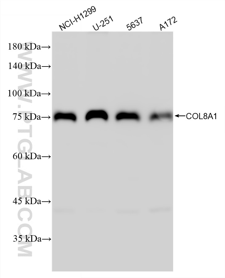 Various lysates were subjected to SDS PAGE followed by western blot with 87280-1-RR (COL8A1 antibody) at dilution of 1:1000 incubated at room temperature for 1.5 hours. This data was developed using the same antibody clone with 87280-1-PBS in a different storage buffer formulation. Western Blot (WB) analysis of various lysates using COL8A1 Recombinant monoclonal antibody (87280-1-RR)