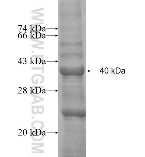 COL8A1 fusion protein Ag10607 SDS-PAGE