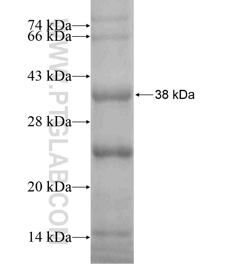 COL8A2 fusion protein Ag17319 SDS-PAGE