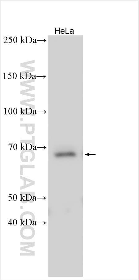 Collagen Type IX