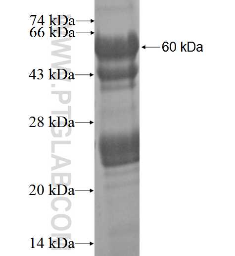 COL9A1 fusion protein Ag3189 SDS-PAGE