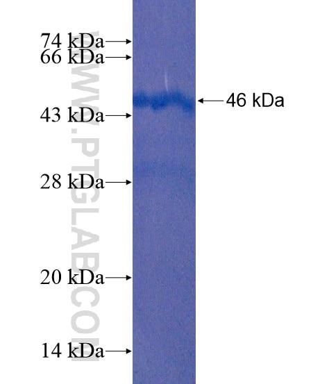 COL9A2 fusion protein Ag21458 SDS-PAGE