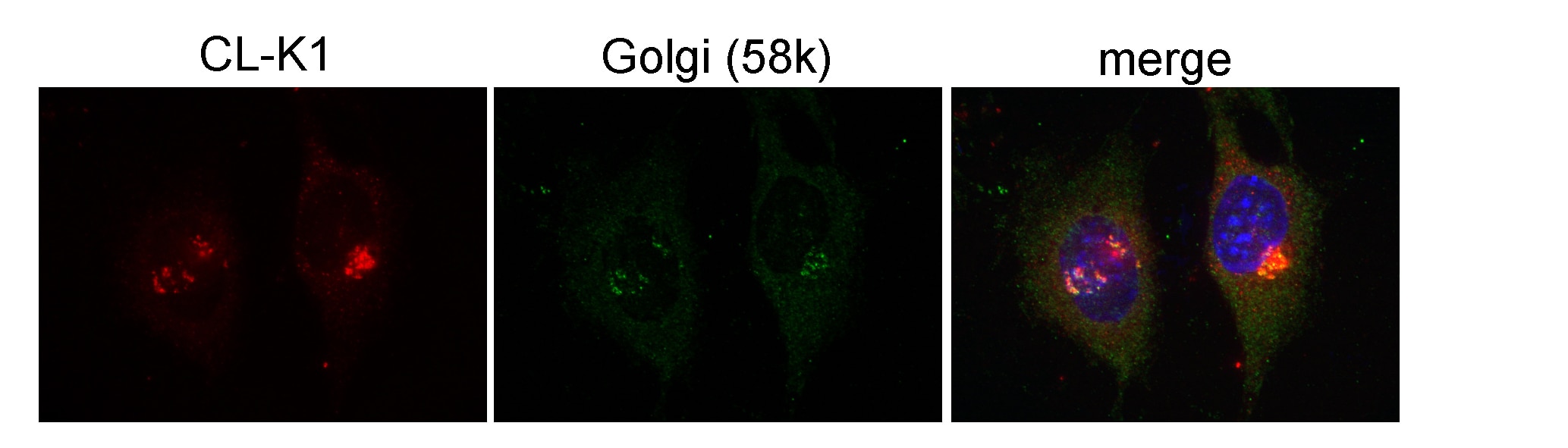 Immunofluorescence (IF) / fluorescent staining of ATCD5 cells using COLEC11 Polyclonal antibody (15269-1-AP)