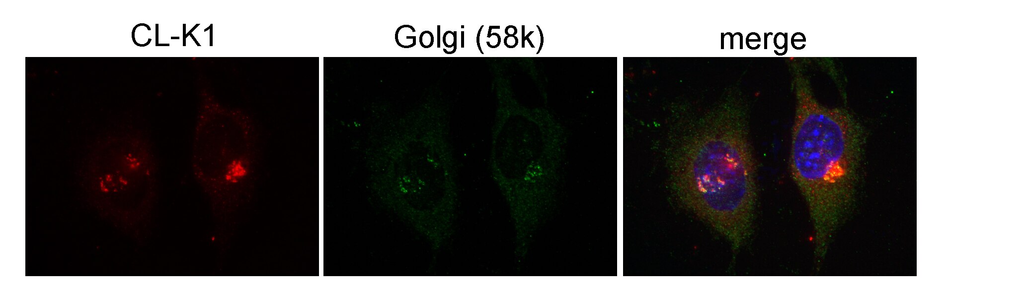 IF Staining of ATCD5 cells using 15269-1-AP