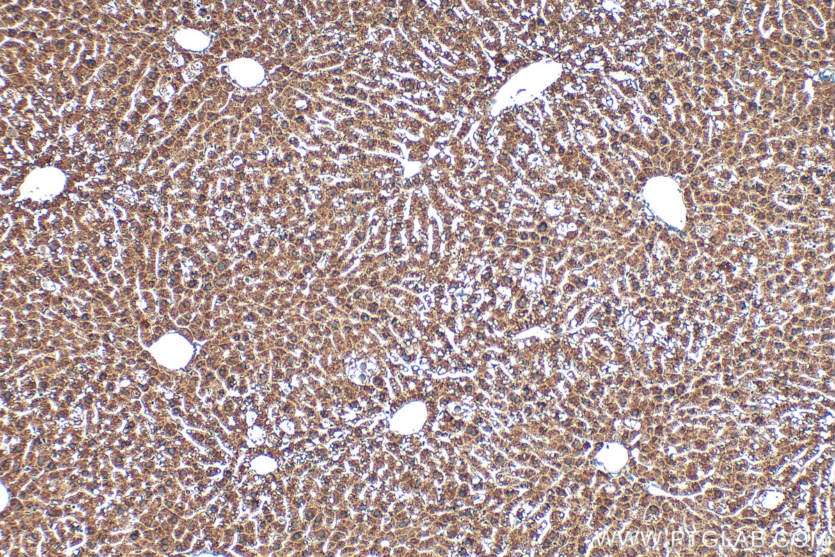 Immunohistochemistry (IHC) staining of mouse liver tissue using COLEC11 Polyclonal antibody (15269-1-AP)