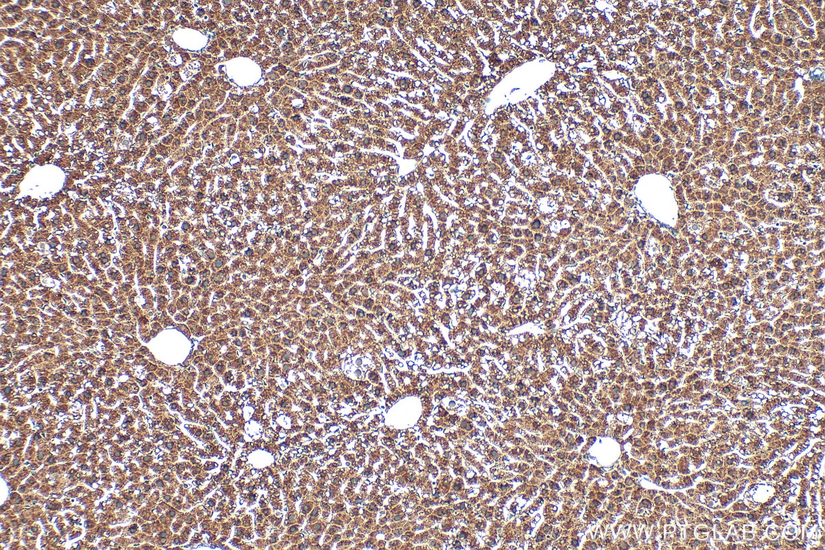 IHC staining of mouse liver using 15269-1-AP