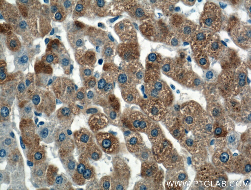 Immunohistochemistry (IHC) staining of human liver tissue using COLEC11 Polyclonal antibody (15269-1-AP)