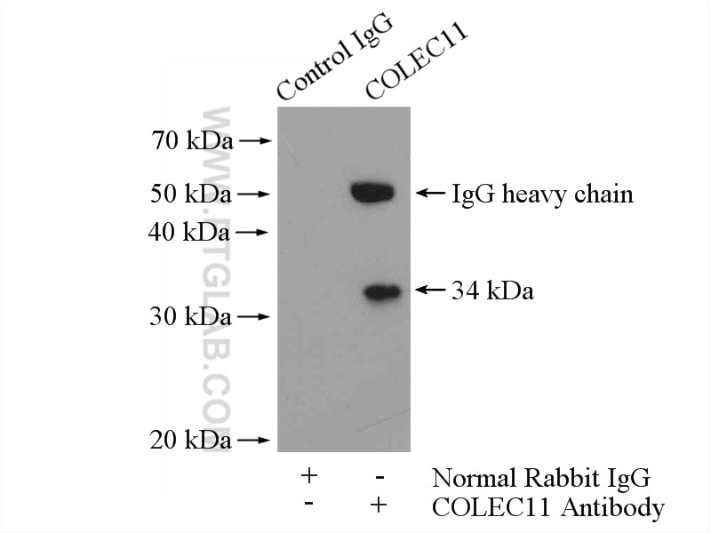 Immunoprecipitation (IP) experiment of mouse liver tissue using COLEC11 Polyclonal antibody (15269-1-AP)
