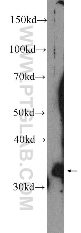 Western Blot (WB) analysis of rat liver tissue using COLEC11 Polyclonal antibody (15269-1-AP)