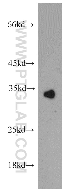 WB analysis of mouse liver using 15269-1-AP