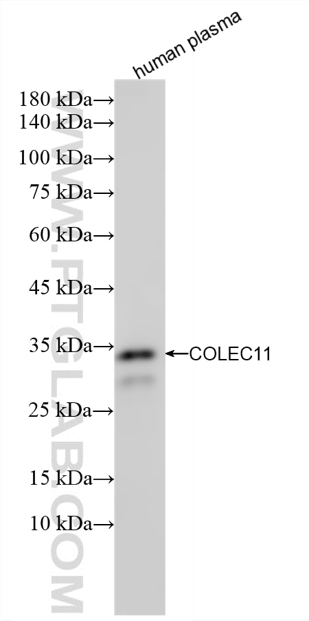 Various lysates were subjected to SDS PAGE followed by western blot with 87193-1-RR (COLEC11 antibody) at dilution of 1:1000 incubated at room temperature for 1.5 hours. Western Blot (WB) analysis of various lysates using COLEC11 Recombinant monoclonal antibody (87193-1-RR)