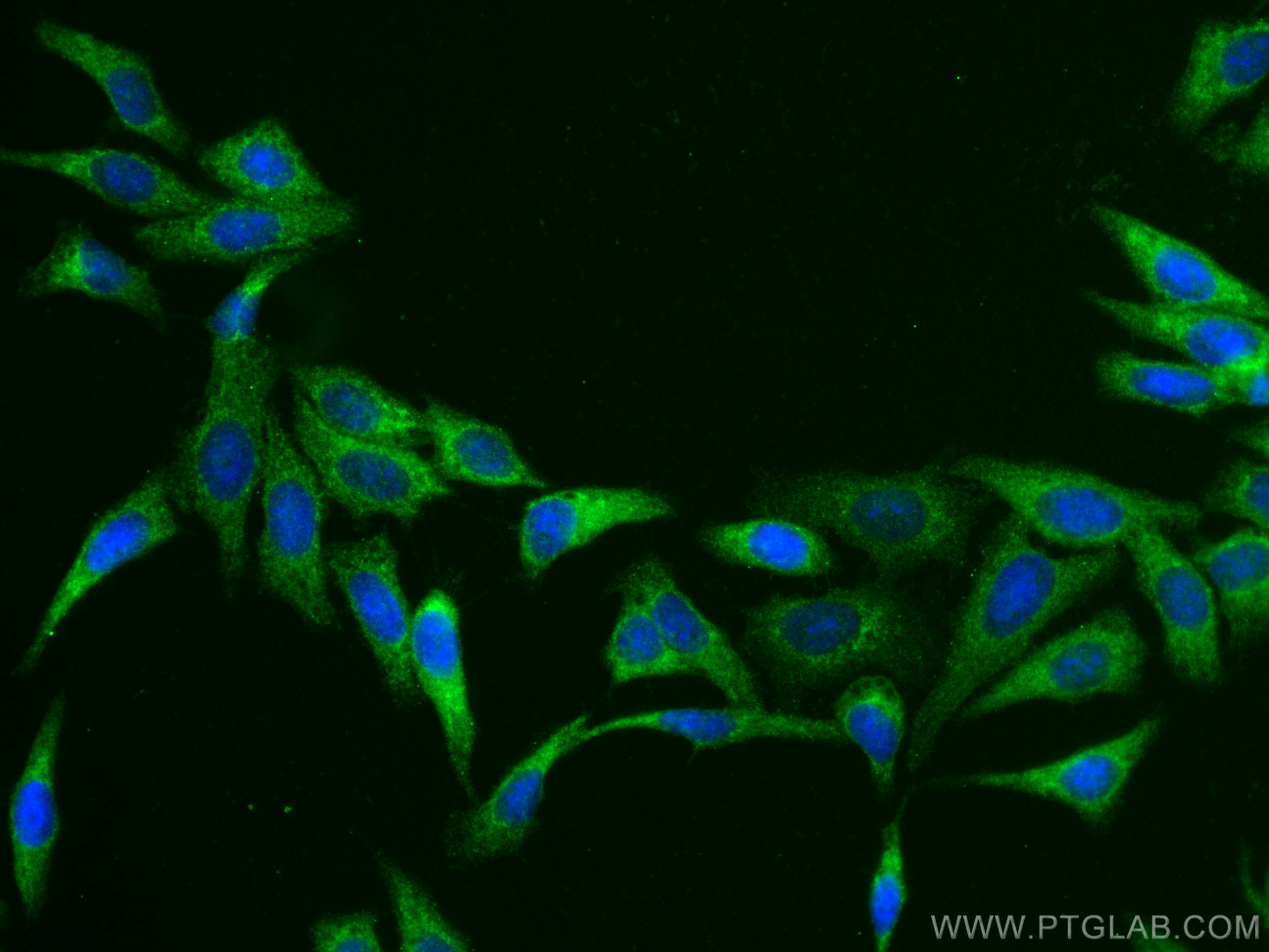 Immunofluorescence (IF) / fluorescent staining of HepG2 cells using COMMD1 Polyclonal antibody (11938-1-AP)