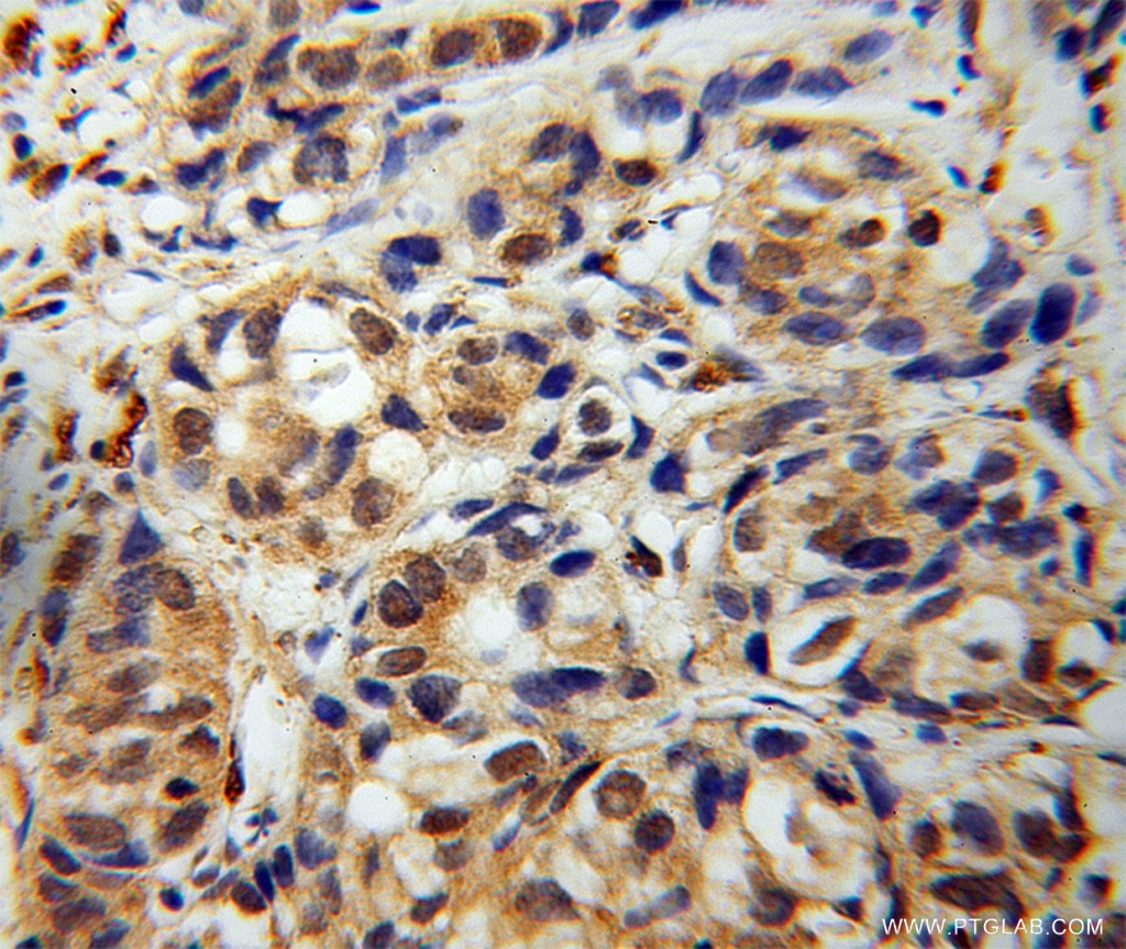 COMMD1 Polyclonal antibody