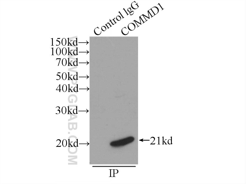 Immunoprecipitation (IP) experiment of mouse brain tissue using COMMD1 Polyclonal antibody (11938-1-AP)