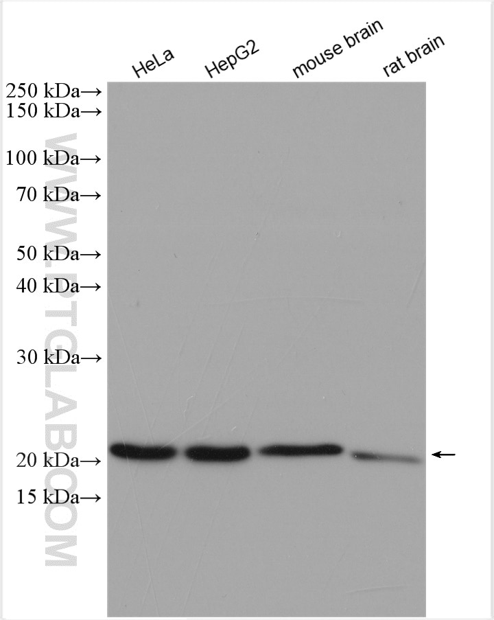 Western Blot (WB) analysis of various lysates using COMMD1 Polyclonal antibody (11938-1-AP)