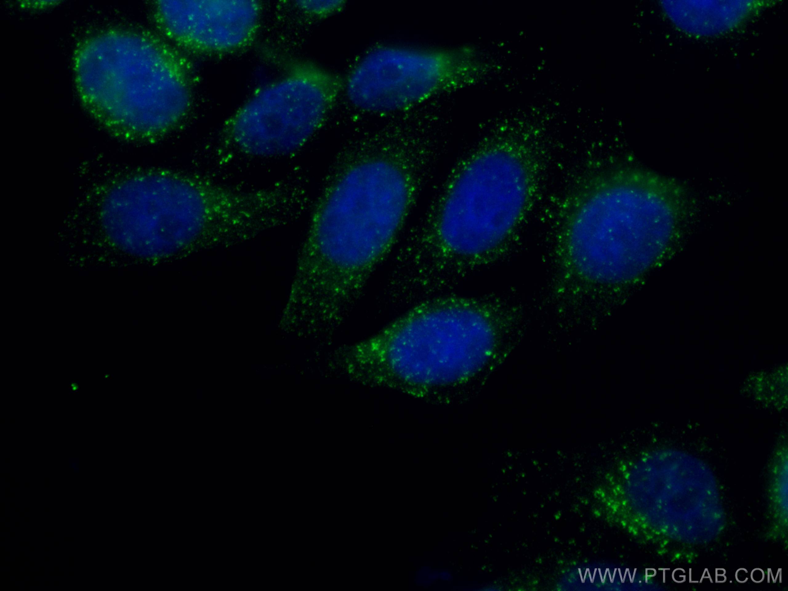 Immunofluorescence (IF) / fluorescent staining of HepG2 cells using COMMD1 Monoclonal antibody (67016-1-Ig)