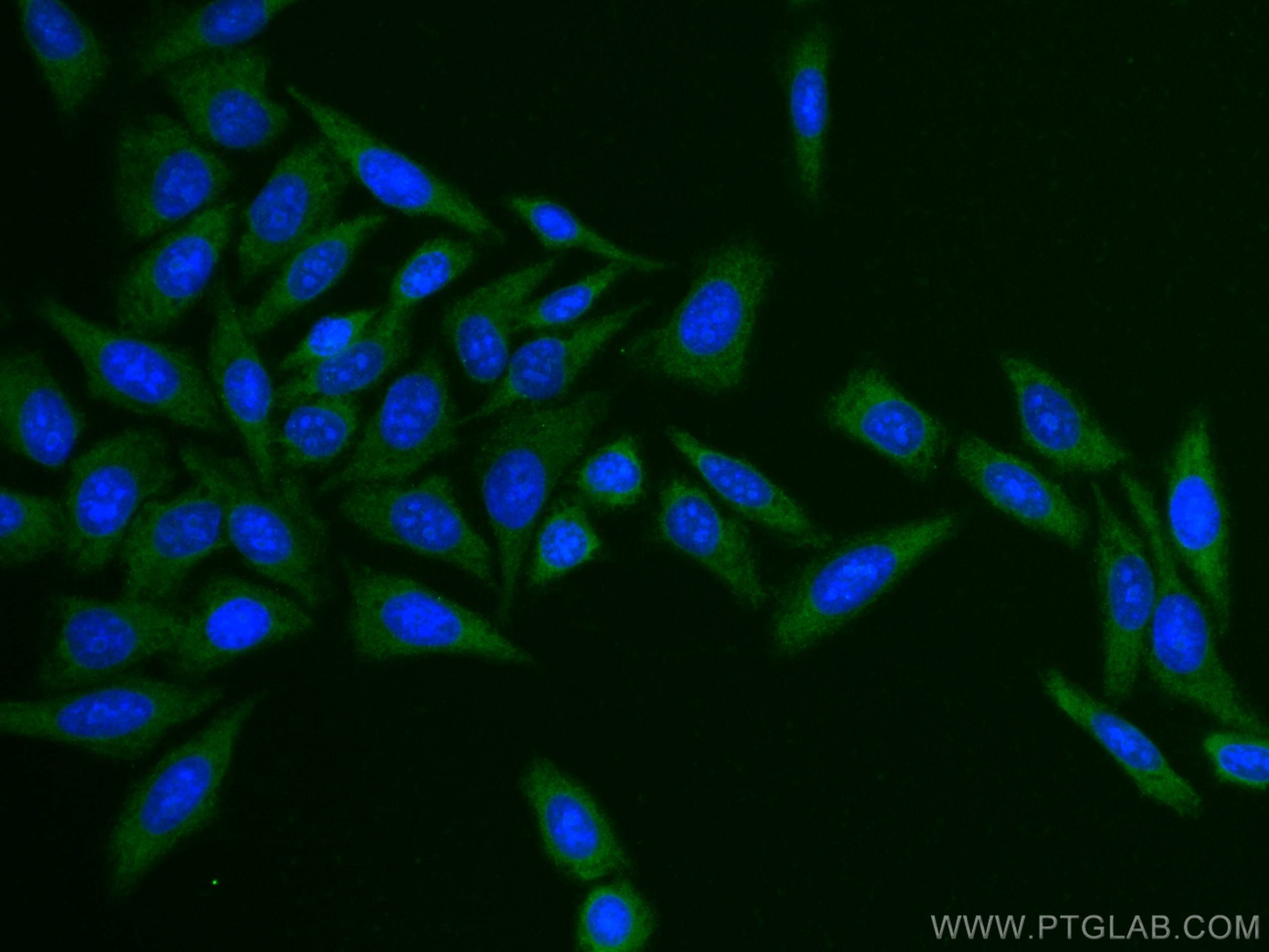 Immunofluorescence (IF) / fluorescent staining of HepG2 cells using CoraLite® Plus 488-conjugated COMMD1 Polyclonal an (CL488-11938)