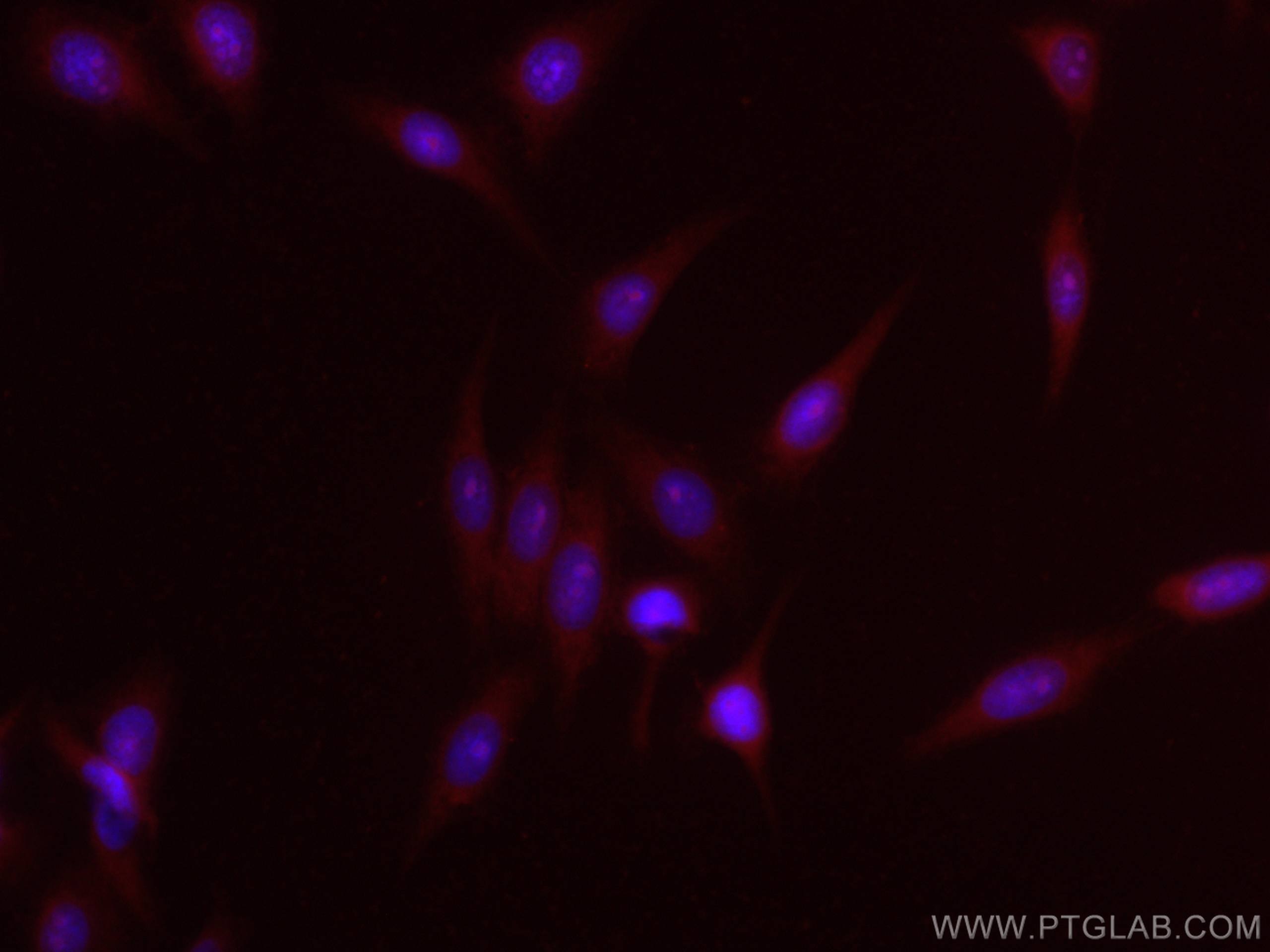 Immunofluorescence (IF) / fluorescent staining of HepG2 cells using CoraLite®594-conjugated COMMD1 Polyclonal antibody (CL594-11938)
