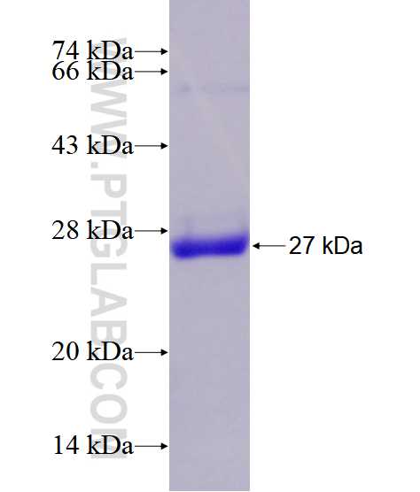 COMMD1 fusion protein Ag28596 SDS-PAGE