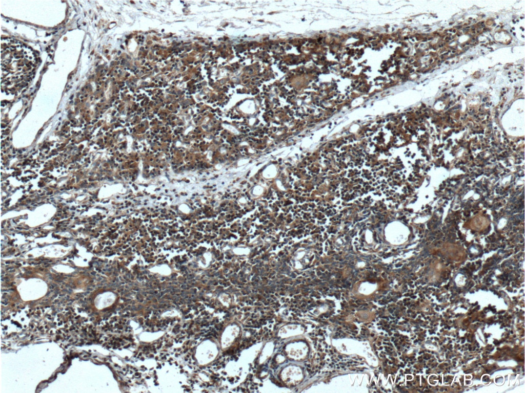 Immunohistochemistry (IHC) staining of human thymus tissue using COMMD3 Polyclonal antibody (26240-1-AP)