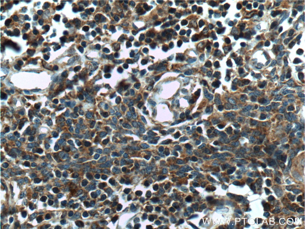 IHC staining of human thymus using 26240-1-AP