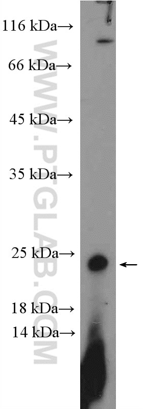 Western Blot (WB) analysis of mouse thymus tissue using COMMD3 Polyclonal antibody (26240-1-AP)