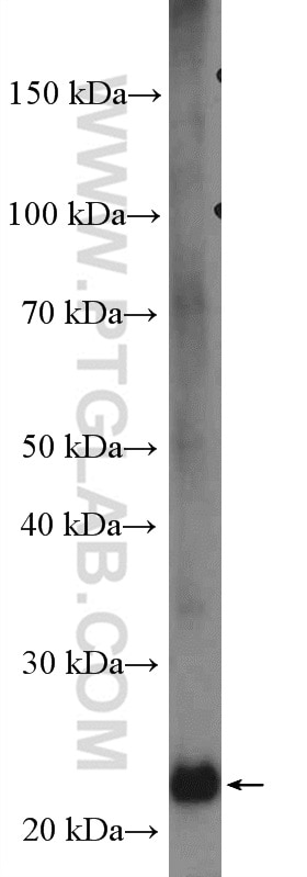 Western Blot (WB) analysis of A549 cells using COMMD3 Polyclonal antibody (26240-1-AP)
