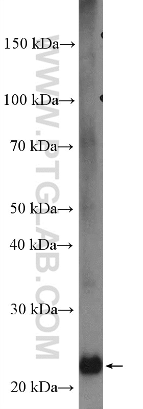WB analysis of A549 using 26240-1-AP