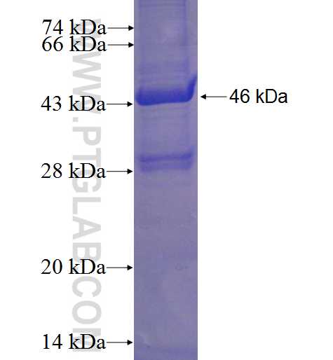 COMMD3 fusion protein Ag23968 SDS-PAGE